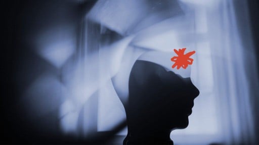 Migraine: How a poor night&amp;#x27;s sleep may trigger headaches
