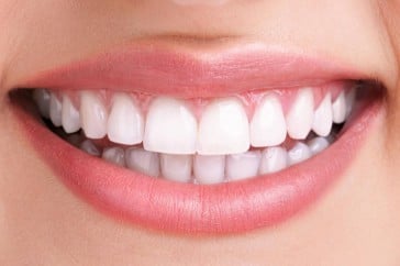 How to Determine if Dental Implants are the Right Choice for Teeth Replacement